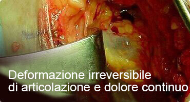 HONDRO SOL DOVE ACQUISTARE