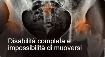 HONDRO SOL DOVE ACQUISTARE